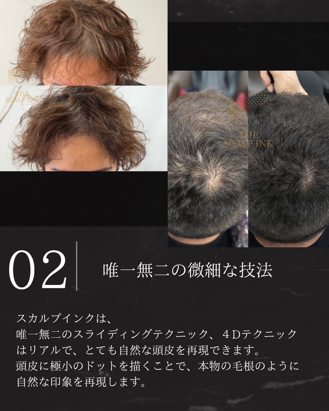 the scalp ink 02.jpg