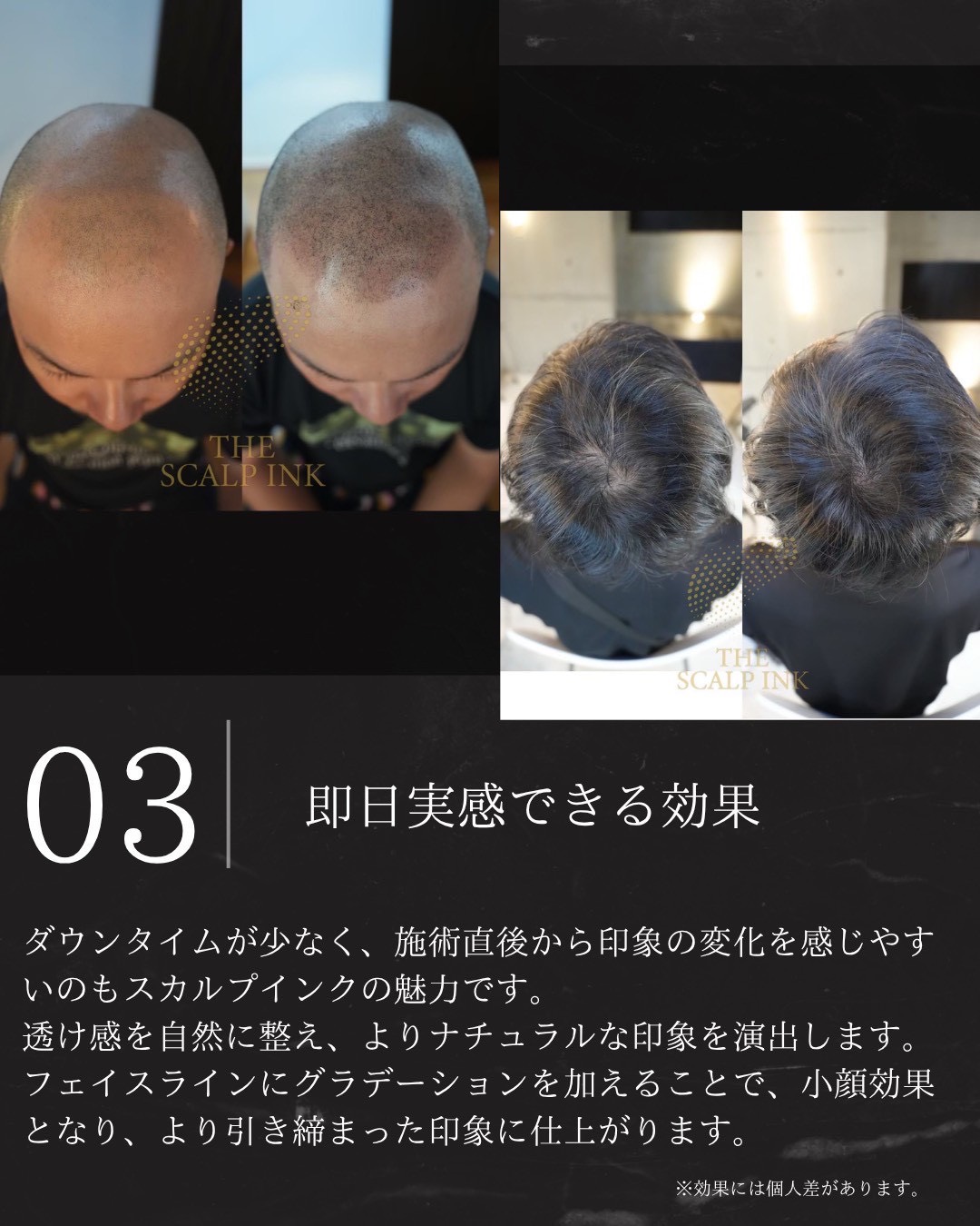 the scalp ink 03.jpg