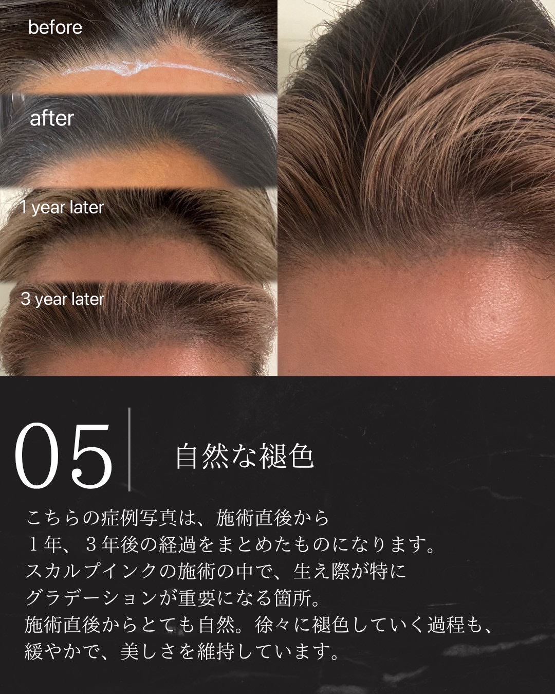 the scalp ink 05.jpg